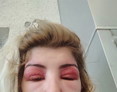 Güzellik merkezi kabusu oldu